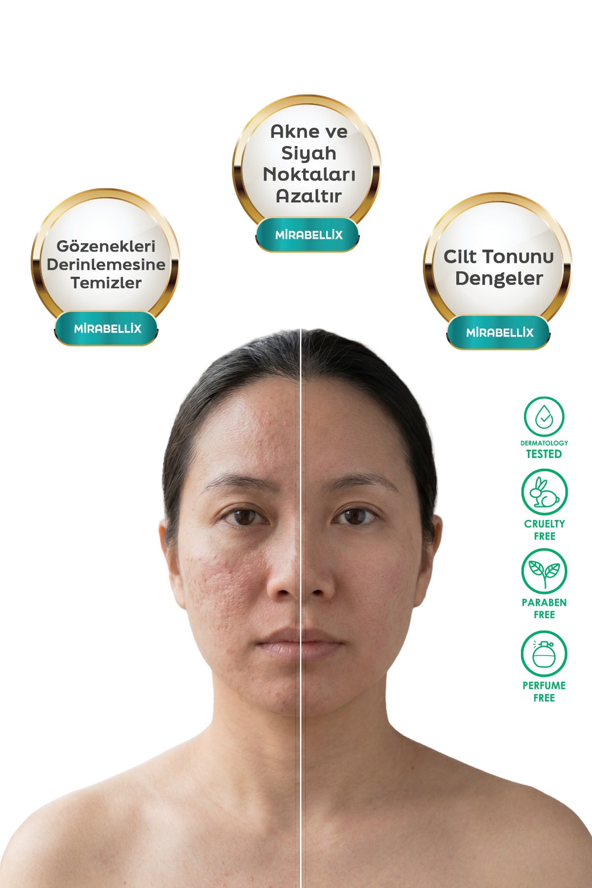 ANTI-ACNE LOTION